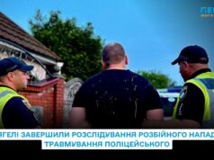 У Звягелі завершили розслідування розбійного нападу та травмування поліцейського