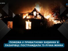 У Житомирському районі під час пожежі в приватному будинку травмувалась 75-річна жінка
