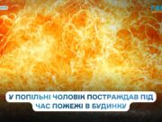 У Попільні чоловік травмувався під час займання у приватному будинку