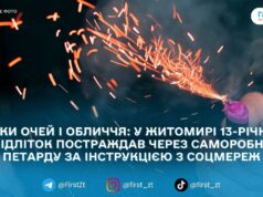 “Небезпечні експерименти” з соцмереж: у Житомирі підліток травмувався під час виготовлення саморобної петарди
