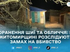 У Житомирському районі затримали підозрюваного в замаху на вбивство 60-річного чоловіка