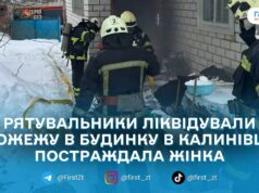 У Калинівці Житомирського району під час пожежі в будинку травмувалася жінка
