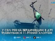 У Бердичівському районі Peugeot збив 11-річного хлопчика на електросамокаті: дитина – в реанімації