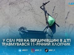 У Бердичівському районі Peugeot збив 11-річного хлопчика на електросамокаті: дитина – в реанімації