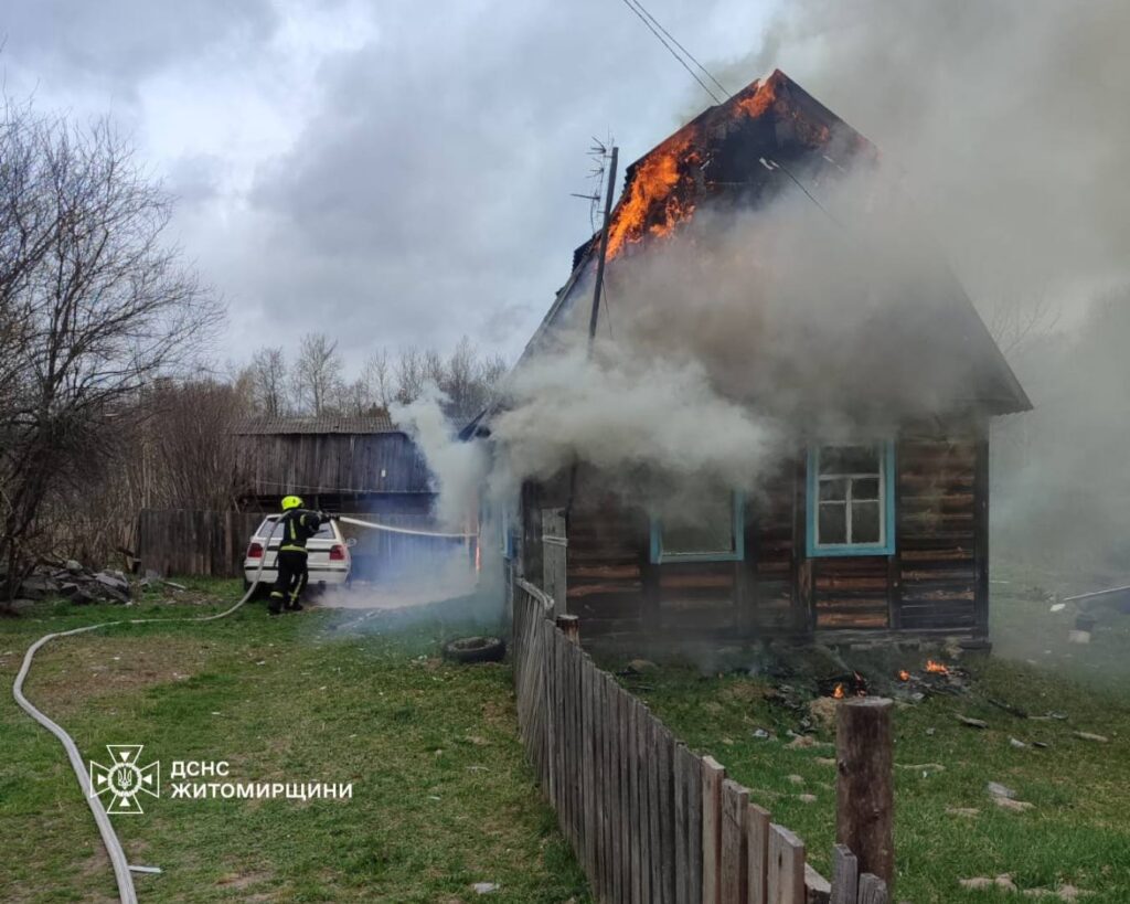Опіки рук та шиї: у Житомирському районі жінка постраждала...
