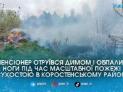 Обпалені ноги та отруєння димом: на Коростенщині 64-річний чоловік ледь не згорів заживо у палаючій траві