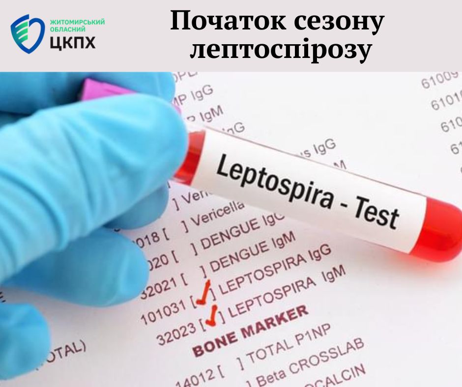 Сезон лептоспірозу Житомирщина симптоми